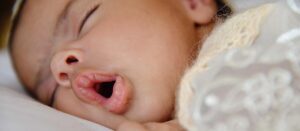 Skrócone wędzidełko języka