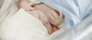 Kręcz szyi u niemowląt